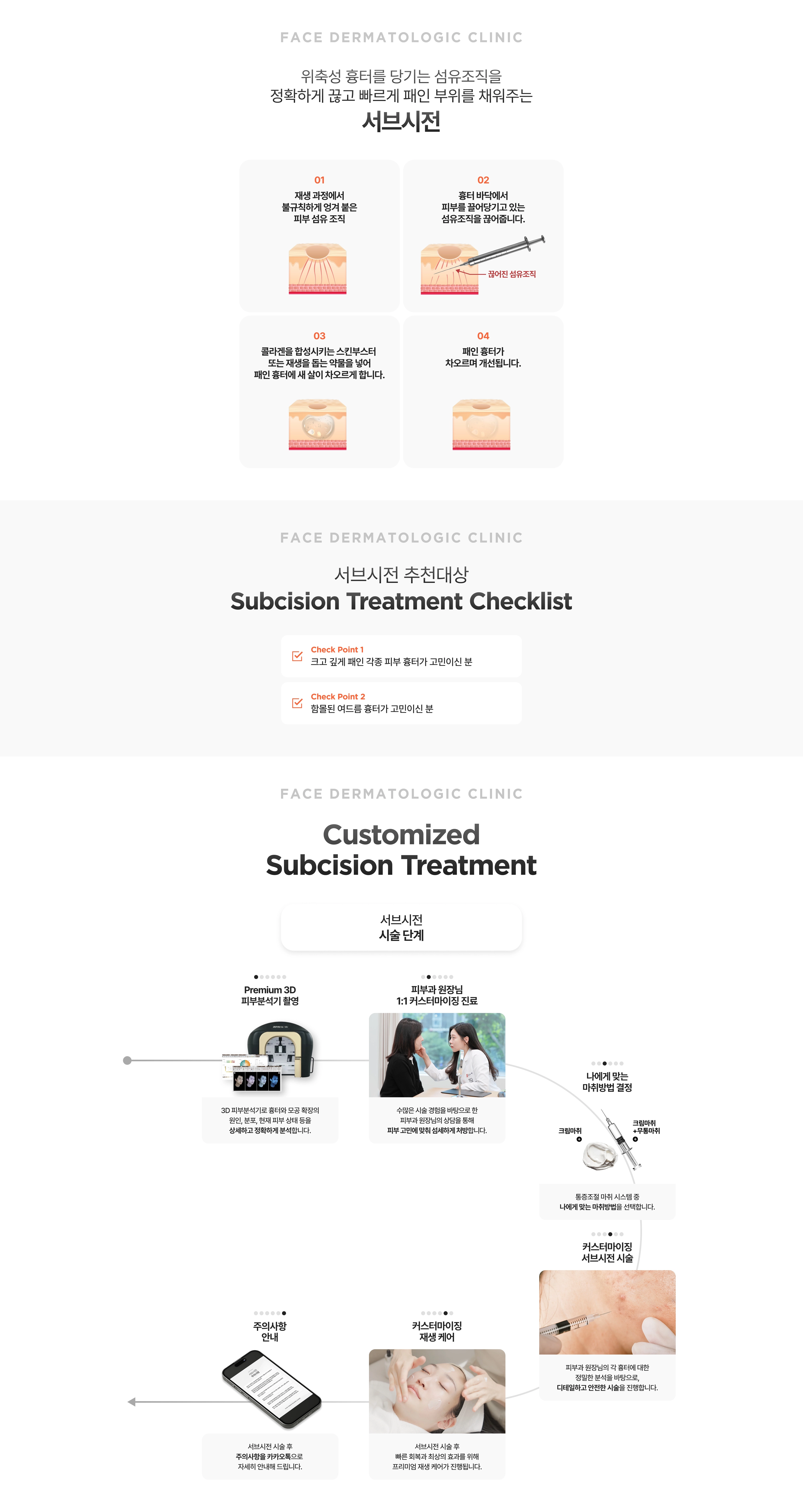 Subcision